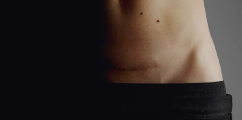 Maia Mum Revive-It C-Section Scar & Stretch Mark Cream – 30ml